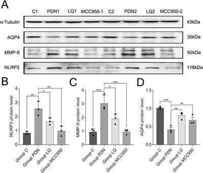 Liquiritin ameliorates painful diabetic neuropathy in SD rats by inhibiting NLRP3-MMP-9-mediated reversal of aquaporin-4 polarity in the glymphatic system